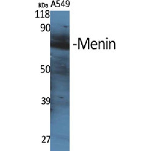 MEN1 / Menin Antibody - Western blot of Menin antibody