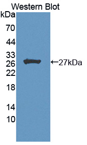 MEN1 / Menin Antibody - Western blot of MEN1 / Menin antibody.