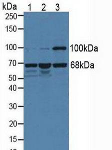 MEN1 / Menin Antibody - Western Blot; Sample: Lane1: Porcine Liver Tissue; Lane2: Porcine Kidney Tissue; Lane3: Human Hela Cells.