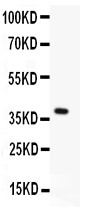 MEN1 / Menin Antibody - Menin antibody Western blot. All lanes: Anti Menin at 0.5 ug/ml. WB: Recombinant Human Menin Protein 0.5ng. Predicted band size: 39 kD. Observed band size: 39 kD.