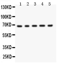 MEN1 / Menin Antibody - Menin antibody Western blot. All lanes: Anti Menin at 0.5 ug/ml. Lane 1: HELA Whole Cell Lysate at 40 ug. Lane 2: 293T Whole Cell Lysate at 40 ug. Lane 3: SMMC Whole Cell Lysate at 40 ug. Lane 4: HEPA Whole Cell Lysate at 40 ug. Lane 5: COLO320 Whole Cell Lysate at 40 ug. Predicted band size: 68 kD. Observed band size: 68 kD.