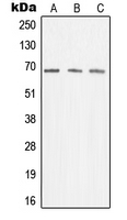 MEN1 / Menin Antibody - Western blot analysis of Menin expression in K562 (A); Jurkat (B); A431 (C) whole cell lysates.