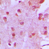 MEN1 / Menin Antibody - Immunohistochemical analysis of Menin staining in human brain formalin fixed paraffin embedded tissue section. The section was pre-treated using heat mediated antigen retrieval with sodium citrate buffer (pH 6.0). The section was then incubated with the antibody at room temperature and detected using an HRP conjugated compact polymer system. DAB was used as the chromogen. The section was then counterstained with hematoxylin and mounted with DPX.