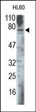 MEN1 / Menin Antibody - The Menin Antibody is used in Western blot to detect Menin in HL-60 cell lysate.