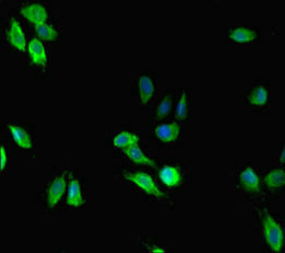 MEN1 / Menin Antibody - Immunofluorescent analysis of Hela cells diluted at 1:100 and Alexa Fluor 488-congugated AffiniPure Goat Anti-Rabbit IgG(H+L)