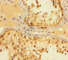 MEN1 / Menin Antibody - Immunohistochemistry of paraffin-embedded human testis tissue at dilution of 1:100