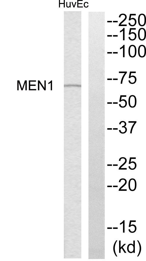MEN1 / Menin Antibody - Western blot analysis of extracts from HuvEc cells, using MEN1 antibody.