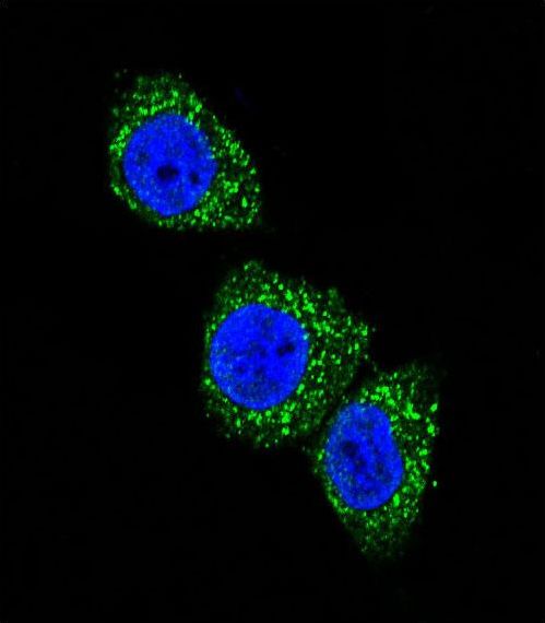 MEN1 / Menin Antibody - Confocal immunofluorescence of MEN1 Antibody (T594) with HeLa cell followed by Alexa Fluor 488-conjugated goat anti-rabbit lgG (green). DAPI was used to stain the cell nuclear (blue).