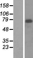 MEN1 / Menin Protein - Western validation with an anti-DDK antibody * L: Control HEK293 lysate R: Over-expression lysate