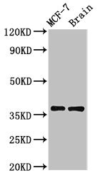 MENT / C1orf56 Antibody - Positive Western Blot detected in MCF-7 whole cell lysate, Rat brain tissue. All lanes: MENT antibody at 3.2 µg/ml Secondary Goat polyclonal to rabbit IgG at 1/50000 dilution. Predicted band size: 37, 19 KDa. Observed band size: 37 KDa