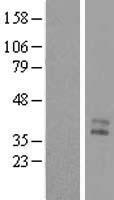 MENT / C1orf56 Protein - Western validation with an anti-DDK antibody * L: Control HEK293 lysate R: Over-expression lysate