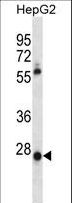 MEOX1 Antibody - MEOX1 Antibody western blot of HepG2 cell line lysates (35 ug/lane). The MEOX1 antibody detected the MEOX1 protein (arrow).