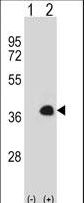 MEOX1 Antibody - Western blot of MEOX1 (arrow) using rabbit polyclonal MEOX1 Antibody. 293 cell lysates (2 ug/lane) either nontransfected (Lane 1) or transiently transfected (Lane 2) with the MEOX1 gene.