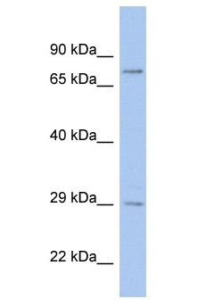 MEOX1 Antibody - MEOX1 antibody Western Blot of SH-SYSY. Antibody dilution: 1 ug/ml.  This image was taken for the unconjugated form of this product. Other forms have not been tested.