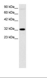 MEOX1 Antibody - Jurkat Cell Lysate.  This image was taken for the unconjugated form of this product. Other forms have not been tested.
