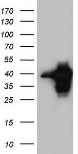 MEOX1 Antibody - HEK293T cells were transfected with the pCMV6-ENTRY control. (Left lane) or pCMV6-ENTRY MEOX1. (Right lane) cDNA for 48 hrs and lysed. Equivalent amounts of cell lysates. (5 ug per lane) were separated by SDS-PAGE and immunoblotted with anti-MEOX1.