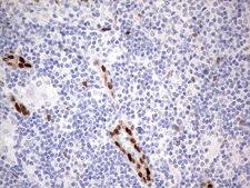 MEOX1 Antibody - Immunohistochemical staining of paraffin-embedded Human lymph node tissue within the normal limits using anti-MEOX1 Mouse monoclonal antibody.  heat-induced epitope retrieval by 1 mM EDTA in 10mM Tris, pH8.5, 120C for 3min)