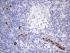 MEOX1 Antibody - Immunohistochemical staining of paraffin-embedded Human lymph node tissue within the normal limits using anti-MEOX1 Mouse monoclonal antibody.  heat-induced epitope retrieval by 1 mM EDTA in 10mM Tris, pH8.5, 120C for 3min)