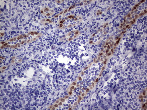 MEOX1 Antibody - Immunohistochemical staining of paraffin-embedded Human tonsil within the normal limits using anti-MEOX1 Mouse monoclonal antibody.  heat-induced epitope retrieval by 1 mM EDTA in 10mM Tris, pH8.5, 120C for 3min)