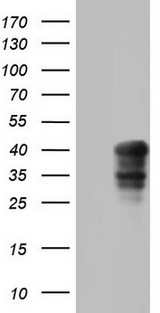 MEOX1 Antibody - HEK293T cells were transfected with the pCMV6-ENTRY control (Left lane) or pCMV6-ENTRY MEOX1 (Right lane) cDNA for 48 hrs and lysed. Equivalent amounts of cell lysates (5 ug per lane) were separated by SDS-PAGE and immunoblotted with anti-MEOX1.