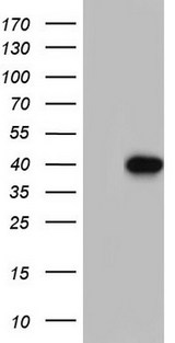 MEOX1 Antibody - HEK293T cells were transfected with the pCMV6-ENTRY control. (Left lane) or pCMV6-ENTRY MEOX1. (Right lane) cDNA for 48 hrs and lysed. Equivalent amounts of cell lysates. (5 ug per lane) were separated by SDS-PAGE and immunoblotted with anti-MEOX1.