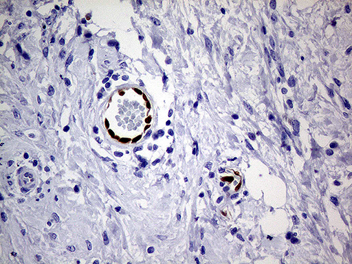 MEOX1 Antibody - Immunohistochemical staining of paraffin-embedded Human breast tissue within the normal limits using anti-MEOX1 mouse monoclonal antibody. (Heat-induced epitope retrieval by 1mM EDTA in 10mM Tris buffer. (pH8.5) at 120°C for 3 min. (1:500)