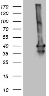 MEOX1 Antibody - HEK293T cells were transfected with the pCMV6-ENTRY control. (Left lane) or pCMV6-ENTRY MEOX1. (Right lane) cDNA for 48 hrs and lysed