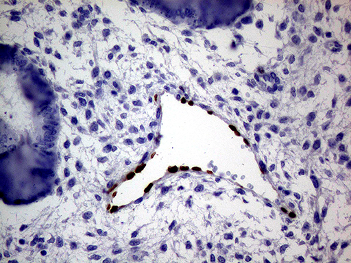 MEOX1 Antibody - Immunohistochemical staining of paraffin-embedded Human endometrium tissue within the normal limits using anti-MEOX1 mouse monoclonal antibody. (Heat-induced epitope retrieval by 1mM EDTA in 10mM Tris buffer. (pH8.5) at 120°C for 3 min. (1:500)