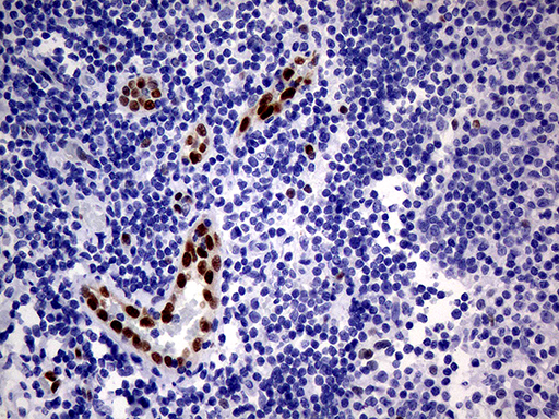 MEOX1 Antibody - Immunohistochemical staining of paraffin-embedded Human tonsil within the normal limits using anti-MEOX1 mouse monoclonal antibody. (Heat-induced epitope retrieval by 1mM EDTA in 10mM Tris buffer. (pH8.5) at 120°C for 3 min. (1:500)