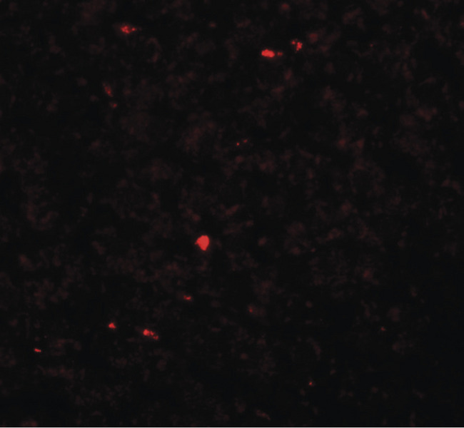 MEOX1 Antibody - Immunofluorescence of MOX1 in rat liver tissue with MOX1 antibody at 20 ug/ml.
