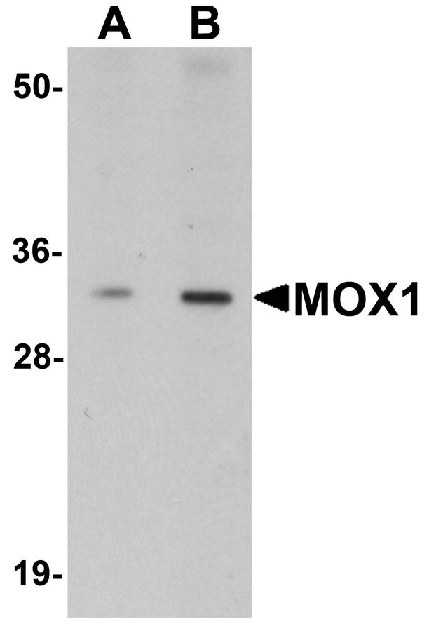 MEOX1 Antibody - Western blot analysis of MOX1 in human liver tissue lysate with MOX1 antibody at (A) 1 and (B) 2 ug/ml.