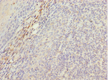 MEOX1 Antibody - Immunohistochemistry of paraffin-embedded human tonsil tissue at dilution 1:100