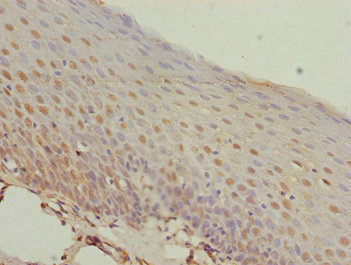 MEOX1 Antibody - Immunohistochemistry of paraffin-embedded human tonsil tissue at dilution 1:100