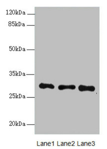 MEOX1 Antibody - Western blot All Lanes:MEOX1 antibody at 3.43ug/ml Lane 1 : Mouse liver tissue Lane 2 : Mouse lung tissue Lane 3 : Mouse kidney tissue Secondary Goat polyclonal to Rabbit IgG at 1/10000 dilution Predicted band size: 28,20,16 kDa Observed band size: 28,90 kDa