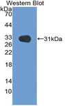 MEP1B Antibody - Western blot of recombinant MEP1B.