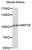 MEP1B Antibody - Western blot analysis of extracts of mouse kidney, using MEP1B antibody at 1:1000 dilution. The secondary antibody used was an HRP Goat Anti-Rabbit IgG (H+L) at 1:10000 dilution. Lysates were loaded 25ug per lane and 3% nonfat dry milk in TBST was used for blocking. An ECL Kit was used for detection and the exposure time was 90s.