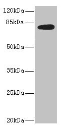 MEP1B Antibody - Western blot All Lanes: MEP1B antibody IgG at 2.36ug/ml+ Mouse kidney tissue Secondary Goat polyclonal to rabbit IgG at 1/10000 dilution Predicted band size: 80 kDa Observed band size: 80 kDa