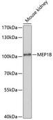 MEP1B Antibody - Western blot analysis of extracts of mouse kidney using MEP1B Polyclonal Antibody at dilution of 1:1000.
