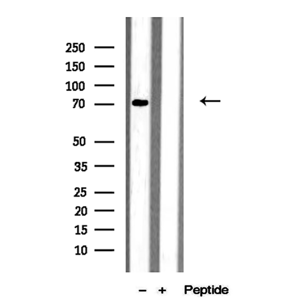 MEPCE Antibody - Western blot analysis of extracts of HeLa cells using MEPCE antibody.