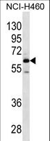 MEPE Antibody - MEPE Antibody western blot of NCI-H460 cell line lysates (35 ug/lane). The MEPE antibody detected the MEPE protein (arrow).