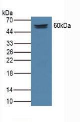 MEPE Antibody - Western Blot; Sample: Rat Serum Tissue.
