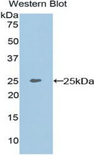 MEPE Antibody - Western blot of recombinant MEPE.  This image was taken for the unconjugated form of this product. Other forms have not been tested.