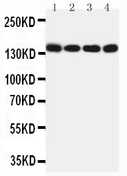 MER / MERTK Antibody - WB of MER / MERTK antibody. All lanes: Anti-MERTK at 0.5ug/ml. Lane 1: HELA Whole Cell Lysate at 40ug. Lane 2: A549 Whole Cell Lysate at 40ug. Lane 3: NIH Whole Cell Lysate at 40ug. Lane 4: 22RV1 Whole Cell Lysate at 40ug. Predicted bind size: 110KD. Observed bind size: 140KD.
