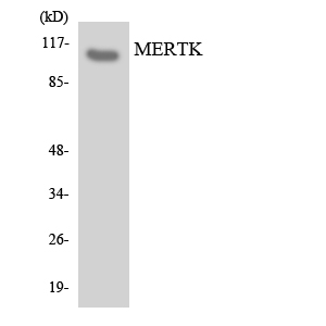 MER / MERTK Antibody - Western blot analysis of the lysates from COLO205 cells using MERTK antibody.