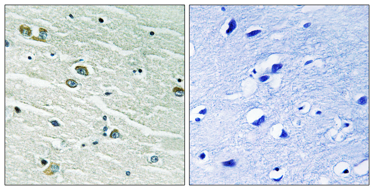 MER / MERTK Antibody - Immunohistochemistry analysis of paraffin-embedded human brain tissue, using MER/SKY Antibody. The picture on the right is blocked with the synthesized peptide.