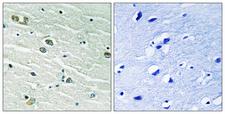 MER / MERTK Antibody - Immunohistochemistry analysis of paraffin-embedded human brain tissue, using MER/SKY Antibody. The picture on the right is blocked with the synthesized peptide.