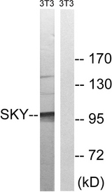 MER / MERTK Antibody - Western blot analysis of lysates from NIH/3T3 cells, treated with EGF 200ng/ml 5', using MER/SKY Antibody. The lane on the right is blocked with the synthesized peptide.