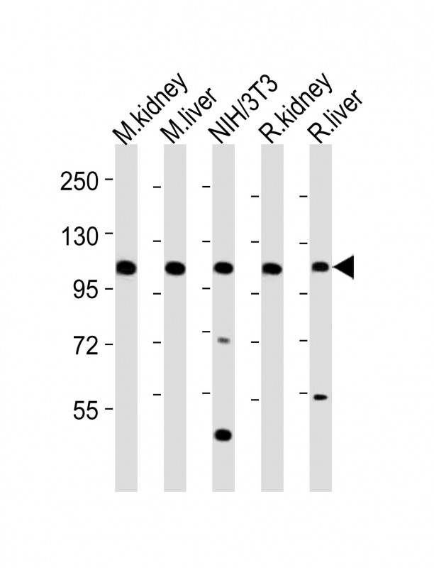 MER / MERTK Antibody - All lanes : Anti-Mertk Antibody at 1:2000 dilution Lane 1: mouse kidney lysates Lane 2: mouse liver lysates Lane 3: NIH/3T3 whole cell lysates Lane 4: rat kidney lysates Lane 5: rat liver lysates Lysates/proteins at 20 ug per lane. Secondary Goat Anti-Rabbit IgG, (H+L), Peroxidase conjugated at 1/10000 dilution Predicted band size : 110 kDa Blocking/Dilution buffer: 5% NFDM/TBST.