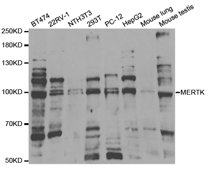 MER / MERTK Antibody - Western blot analysis of extracts of various cell lines, using MERTK antibody.