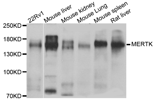 MER / MERTK Antibody - Western blot analysis of extract of various cells.